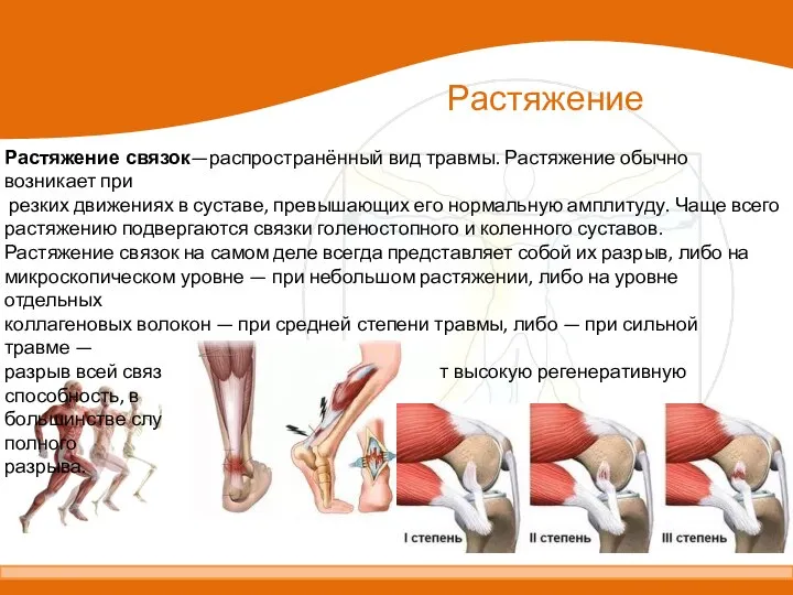 Растяжение связок—распространённый вид травмы. Растяжение обычно возникает при резких движениях в