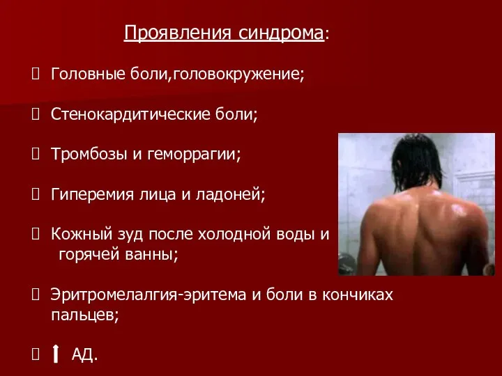 Проявления синдрома: Головные боли,головокружение; Стенокардитические боли; Тромбозы и геморрагии; Гиперемия лица