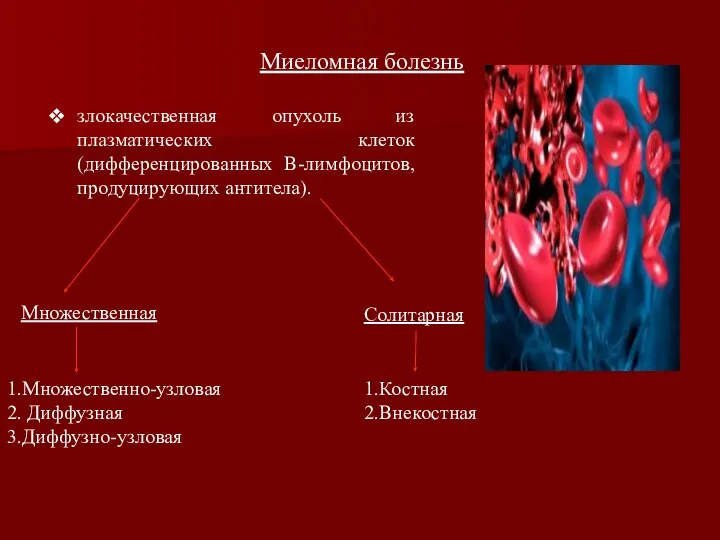 Миеломная болезнь злокачественная опухоль из плазматических клеток (дифференцированных B-лимфоцитов, продуцирующих антитела).