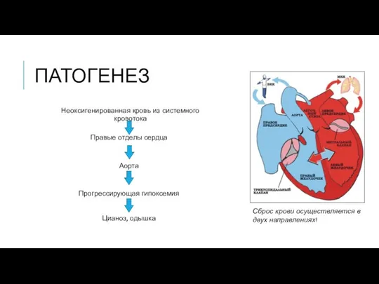 ПАТОГЕНЕЗ Неоксигенированная кровь из системного кровотока Сброс крови осуществляется в двух