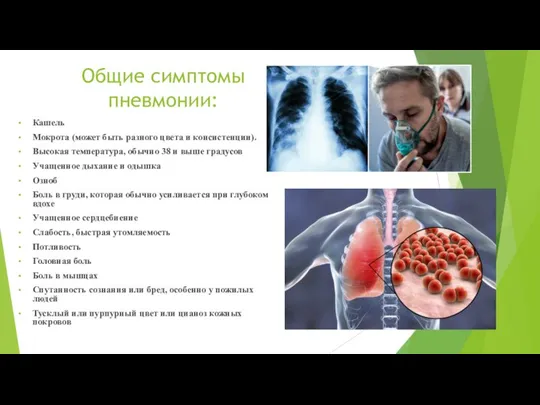 Общие симптомы пневмонии: Кашель Мокрота (может быть разного цвета и консистенции).