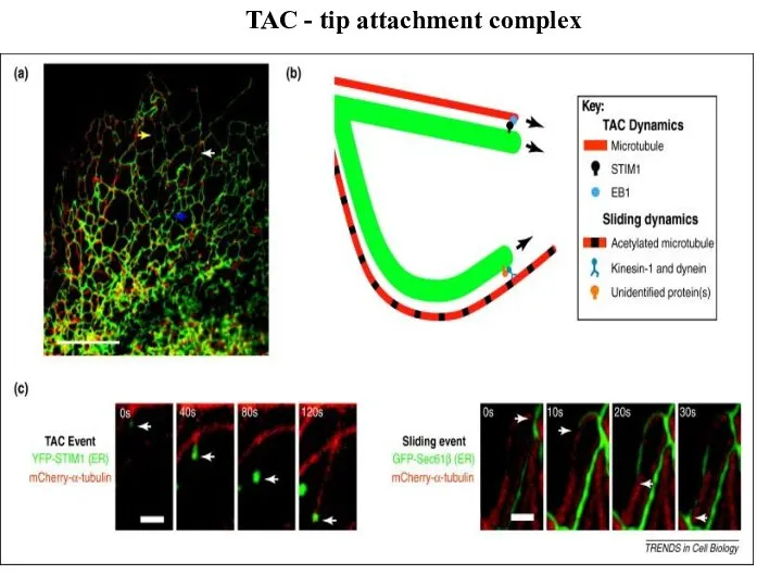 TAC - tip attachment complex