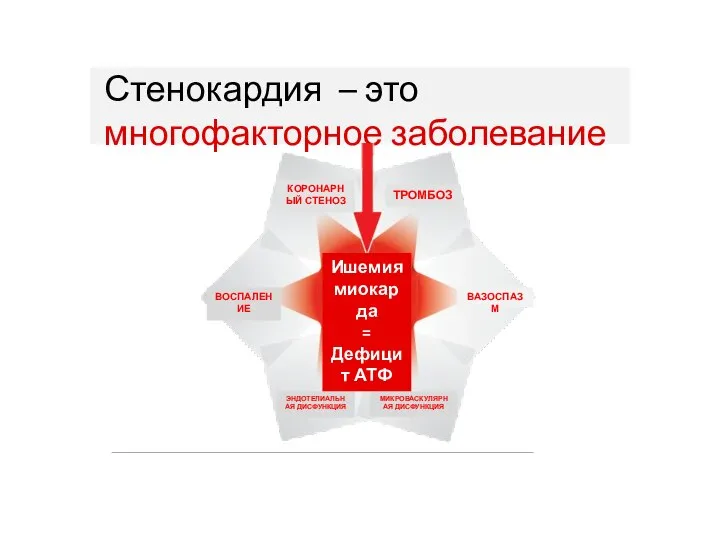 Стенокардия – это многофакторное заболевание ТРОМБОЗ КОРОНАРНЫЙ СТЕНОЗ ВОСПАЛЕНИЕ ВАЗОСПАЗМ МИКРОВАСКУЛЯРНАЯ