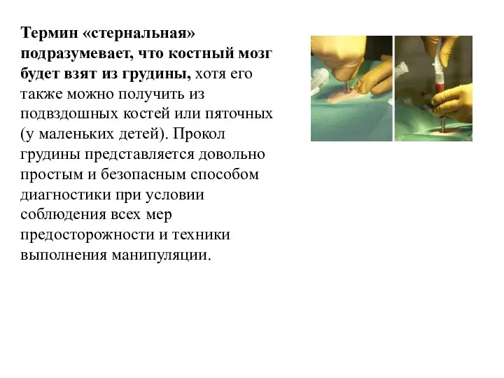 Термин «стернальная» подразумевает, что костный мозг будет взят из грудины, хотя