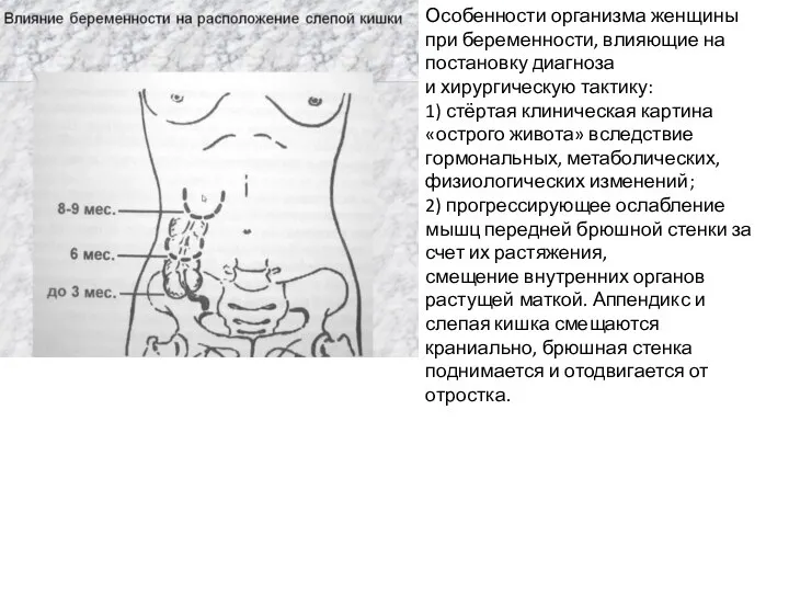 Особенности организма женщины при беременности, влияющие на постановку диагноза и хирургическую