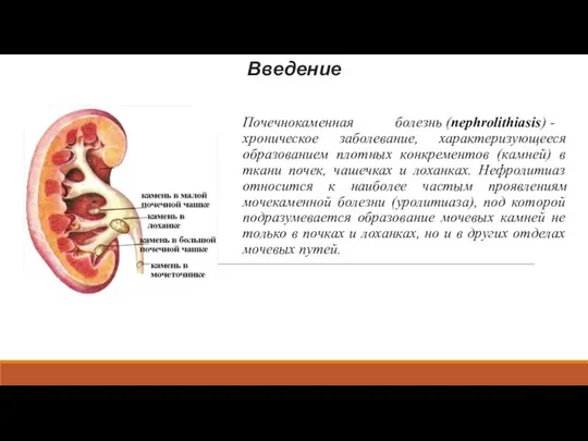 Введение Почечнокаменная болезнь (nephrolithiasis) - хроническое заболевание, характеризующееся образованием плотных конкрементов