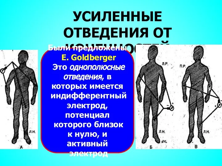 УСИЛЕННЫЕ ОТВЕДЕНИЯ ОТ КОНЕЧНОСТЕЙ Были предложены E. Goldberger Это однополюсные отведения,