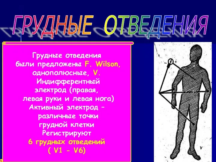 ГРУДНЫЕ ОТВЕДЕНИЯ Грудные отведения были предложены F. Wilson, однополюсные, V. Индифферентный