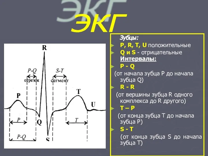 Зубцы: Р, R, T, U положительные Q и S - отрицательные