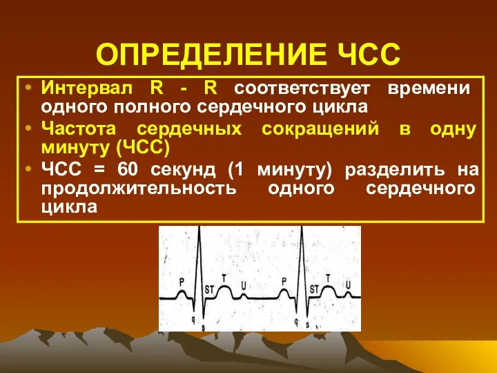 ОПРЕДЕЛЕНИЕ ЧСС Интервал R - R соответствует времени одного полного сердечного