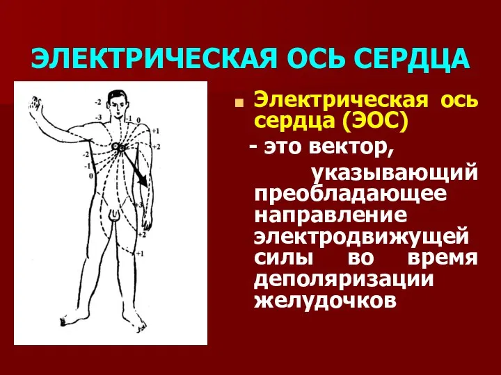 ЭЛЕКТРИЧЕСКАЯ ОСЬ СЕРДЦА Электрическая ось сердца (ЭОС) - это вектор, указывающий