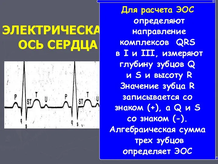 ЭЛЕКТРИЧЕСКАЯ ОСЬ СЕРДЦА Для расчета ЭОС определяют направление комплексов QRS в