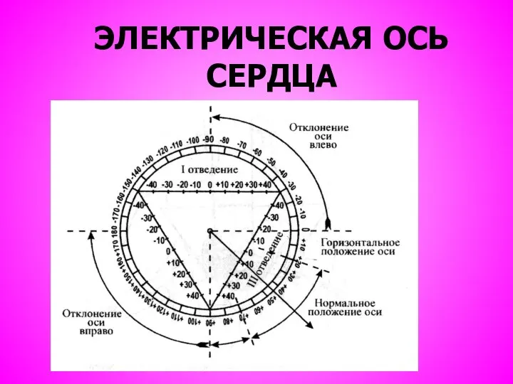 ЭЛЕКТРИЧЕСКАЯ ОСЬ СЕРДЦА