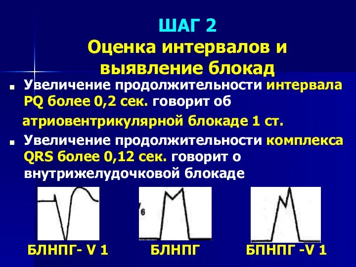 ШАГ 2 Оценка интервалов и выявление блокад Увеличение продолжительности интервала РQ