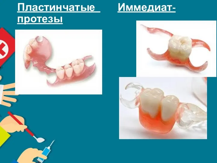 Пластинчатые Иммедиат-протезы