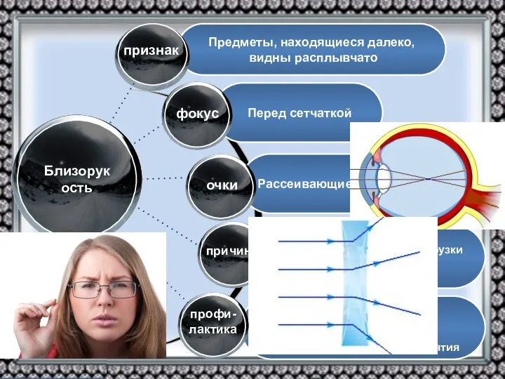 Режим освещения Режим зрительных нагрузок Тренировка мышц Общеукрепляющие мероприятия Рассеивающие линзы