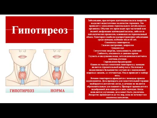 Заболевание, при котором щитовидная железа напротив выделяет недостаточное количество гормонов. Это