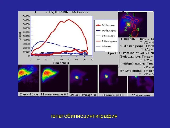 гепатобилисцинтиграфия