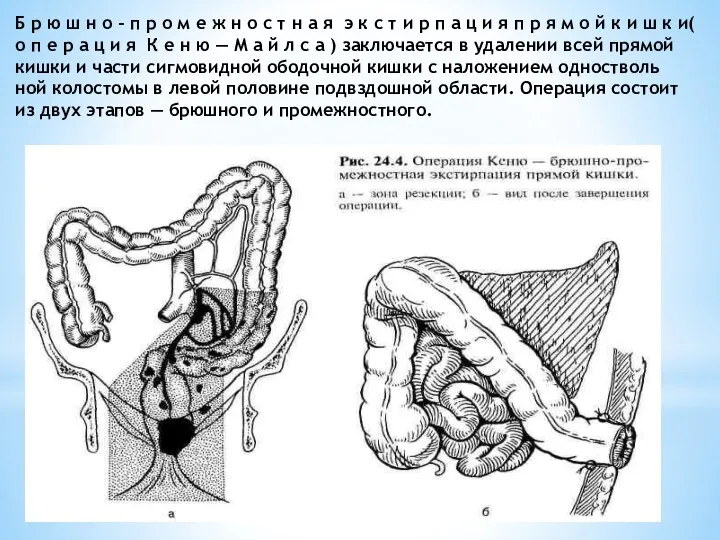 Б р ю ш н о - п р о м