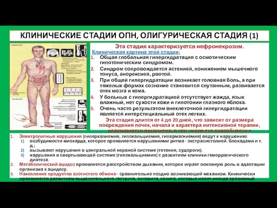 КЛИНИЧЕСКИЕ СТАДИИ ОПН, ОЛИГУРИЧЕСКАЯ СТАДИЯ (1) Эта стадия характеризуется нефронекрозом. Клиническая