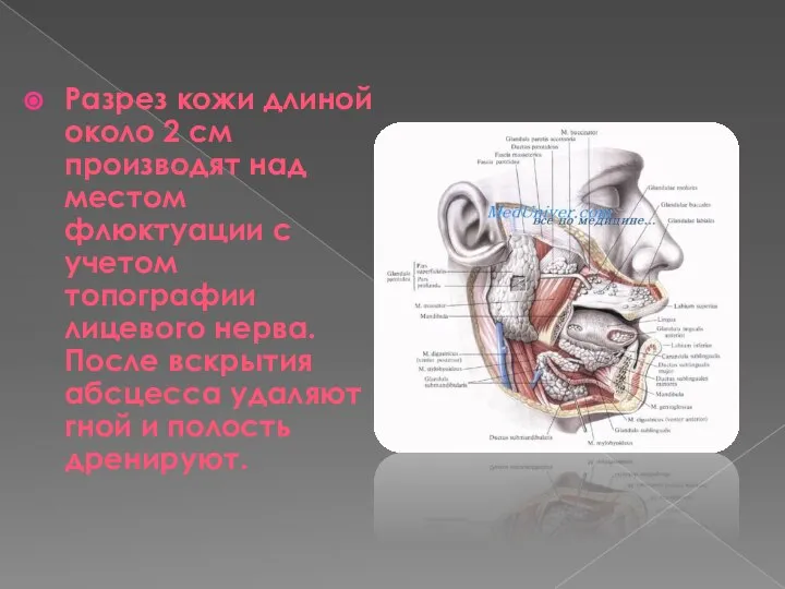 Разрез кожи длиной около 2 см производят над местом флюктуации с