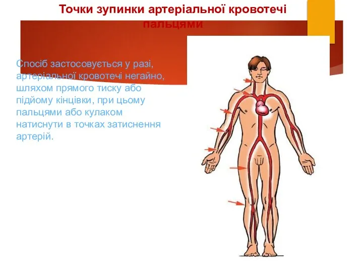 Точки зупинки артеріальної кровотечі пальцями Спосіб застосовується у разі, артеріальної кровотечі