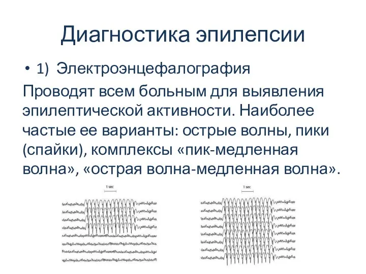 Диагностика эпилепсии 1) Электроэнцефалография Проводят всем больным для выявления эпилептической активности.