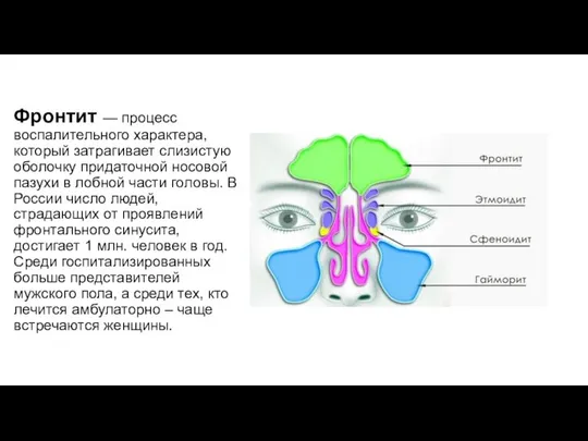 Фронтит — процесс воспалительного характера, который затрагивает слизистую оболочку придаточной носовой