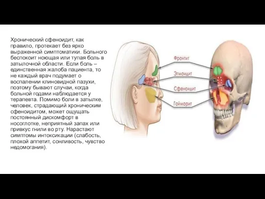 Хронический сфеноидит, как правило, протекает без ярко выраженной симптоматики. Больного беспокоит