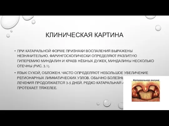 КЛИНИЧЕСКАЯ КАРТИНА ПРИ КАТАРАЛЬНОЙ ФОРМЕ ПРИЗНАКИ ВОСПАЛЕНИЯ ВЫРАЖЕНЫ НЕЗНАЧИТЕЛЬНО. ФАРИНГОСКОПИЧЕСКИ ОПРЕДЕЛЯЮТ