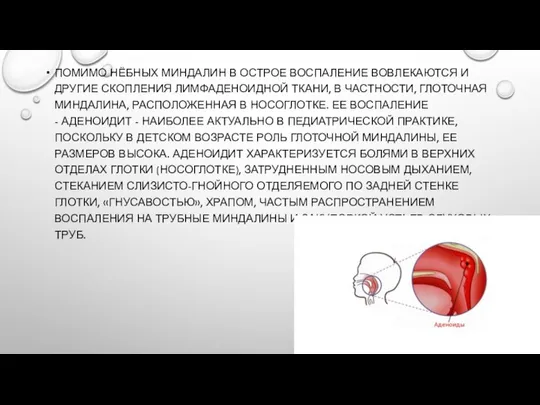 ПОМИМО НЁБНЫХ МИНДАЛИН В ОСТРОЕ ВОСПАЛЕНИЕ ВОВЛЕКАЮТСЯ И ДРУГИЕ СКОПЛЕНИЯ ЛИМФАДЕНОИДНОЙ