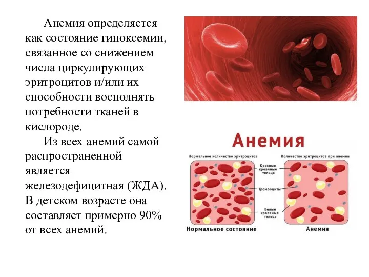 Анемия определяется как состояние гипоксемии, связанное со снижением числа циркулирующих эритроцитов