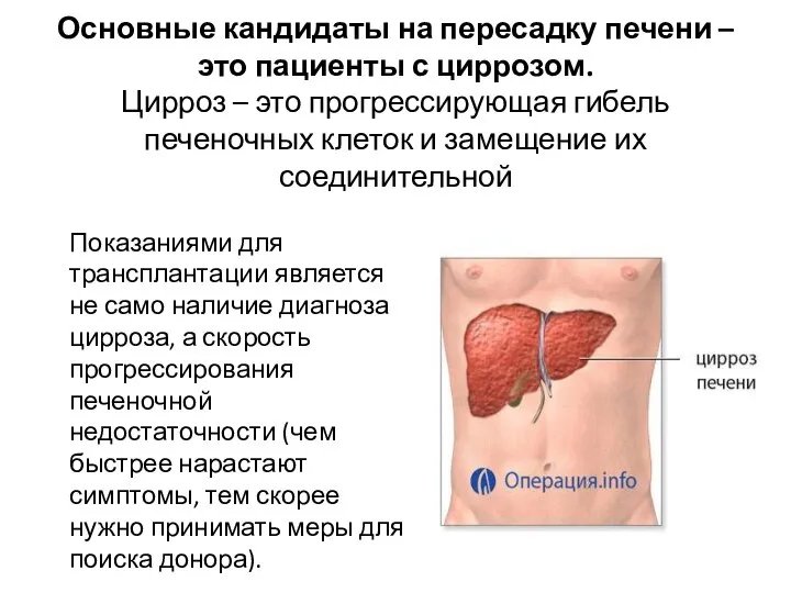 Основные кандидаты на пересадку печени – это пациенты с циррозом. Цирроз