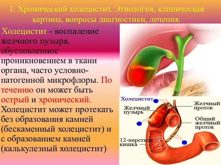 1. Хронический холецистит. Этиология, клиническая картина, вопросы диагностики, лечения. Холецистит -