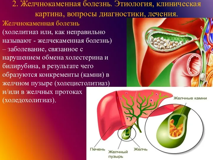 2. Желчнокаменная болезнь. Этиология, клиническая картина, вопросы диагностики, лечения. Желчнокаменная болезнь