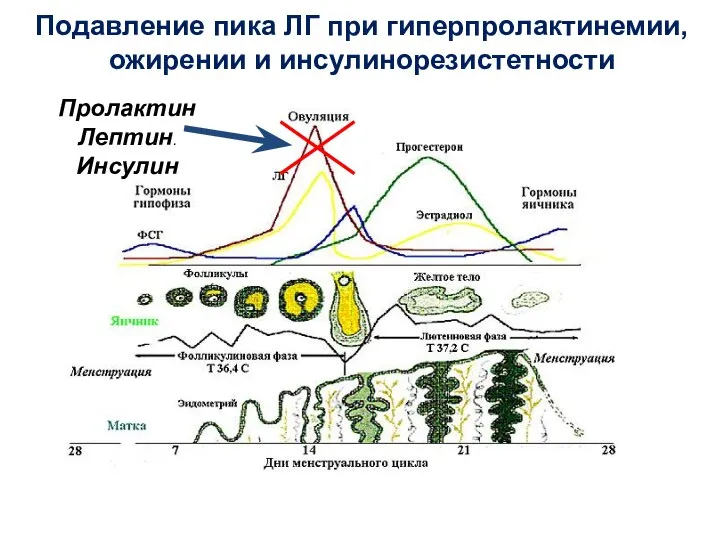 Подавление пика ЛГ при гиперпролактинемии, ожирении и инсулинорезистетности Пролактин Лептин. Инсулин