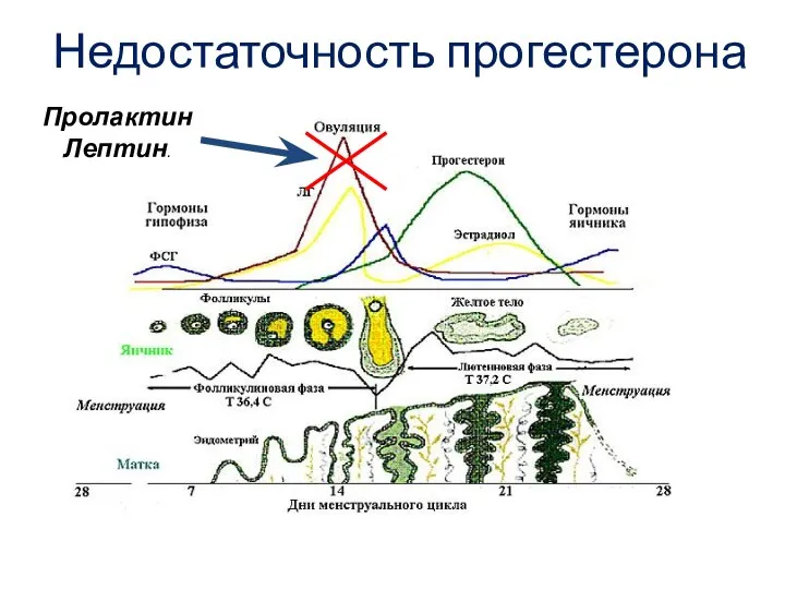 Пролактин Лептин. Недостаточность прогестерона