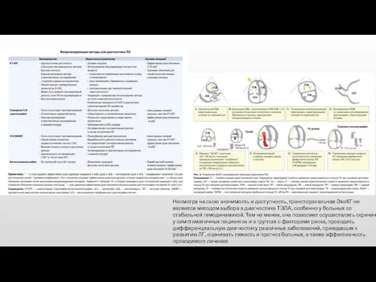 Несмотря на свою значимость и доступность, трансторакальная ЭхоКГ не является методом
