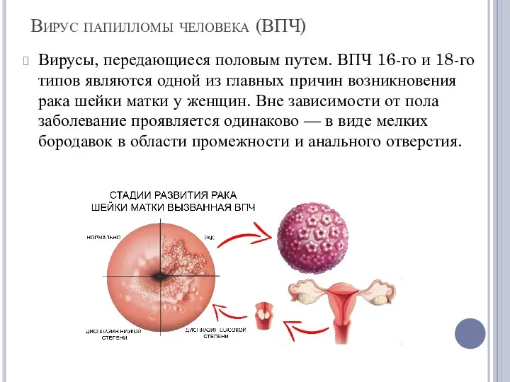 Вирус папилломы человека (ВПЧ) Вирусы, передающиеся половым путем. ВПЧ 16-го и