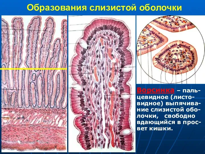 Образования слизистой оболочки Ворсинка – паль- цевидное (листо- видное) выпячива- ние