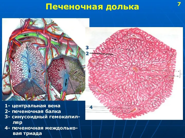 Печеночная долька 1- центральная вена 2- печеночная балка 3- синусоидный гемокапил-