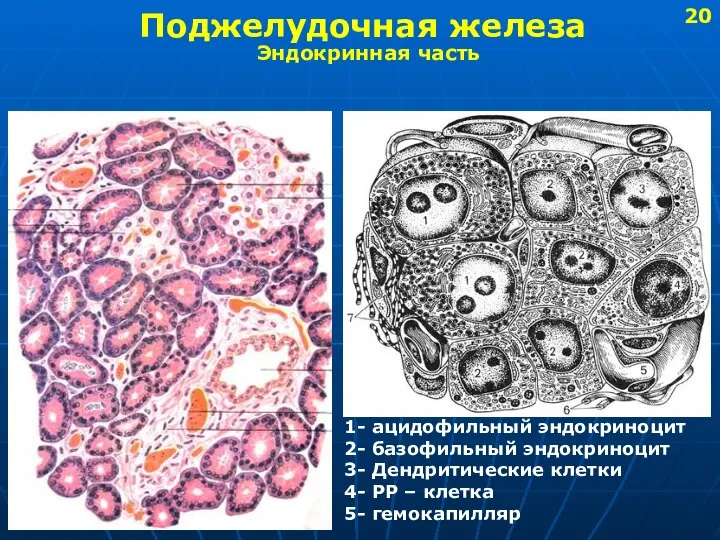 Поджелудочная железа Эндокринная часть 1- ацидофильный эндокриноцит 2- базофильный эндокриноцит 3-