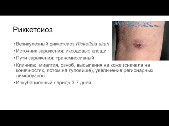 Риккетсиоз Везикулезный риккетсиоз Rickettsia akari Источник заражения: иксодовые клещи Пути заражения: