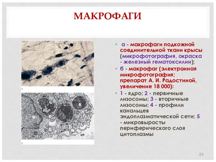 МАКРОФАГИ а - макрофаги подкожной соединительной ткани крысы (микрофотография, окраска -