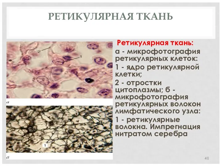 РЕТИКУЛЯРНАЯ ТКАНЬ Ретикулярная ткань: а - микрофотография ретикулярных клеток: 1 -