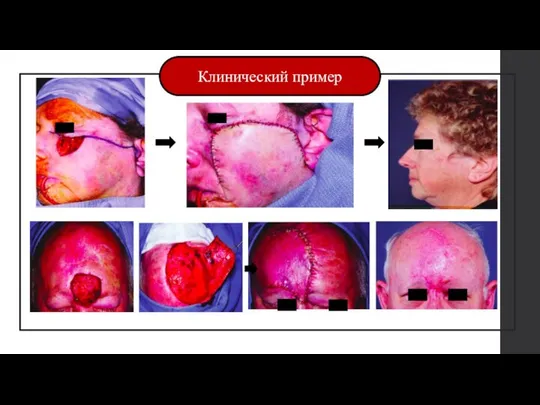 Клинический пример