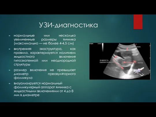 УЗИ-диагностика нормальные или несколько увеличенные размеры яичника (максимально — не более