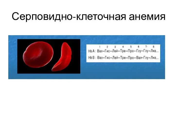 Серповидно-клеточная анемия