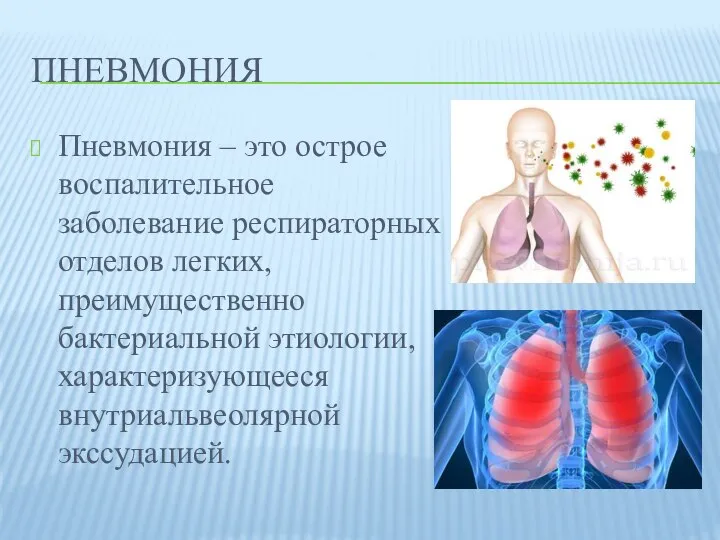 ПНЕВМОНИЯ Пневмония – это острое воспалительное заболевание респираторных отделов легких, преимущественно бактериальной этиологии, характеризующееся внутриальвеолярной экссудацией.