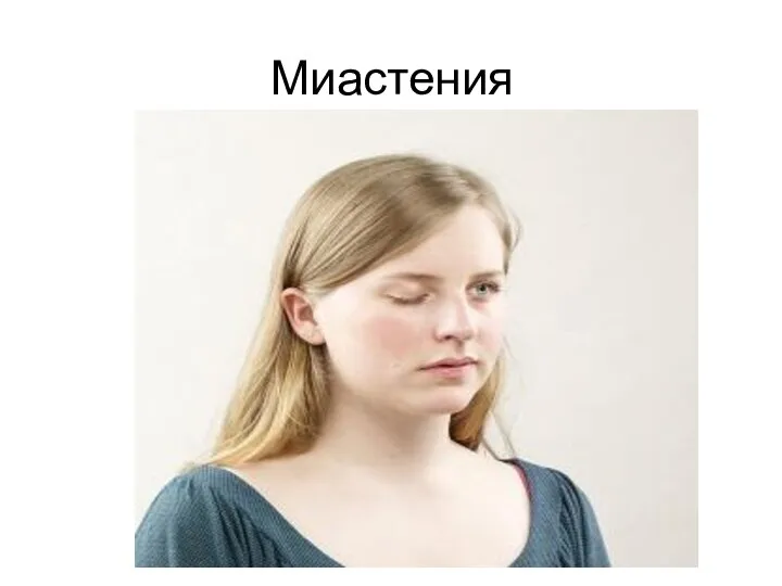 Миастения